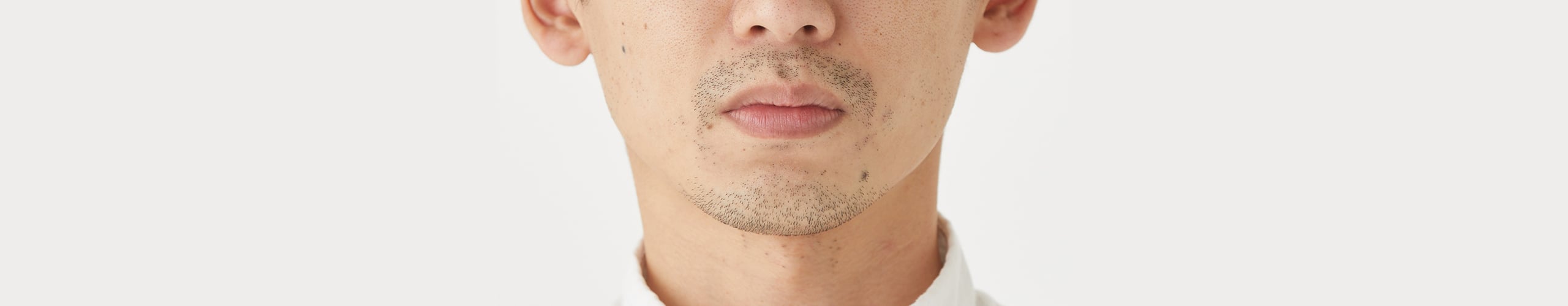 ヒゲ脱毛の症例一覧