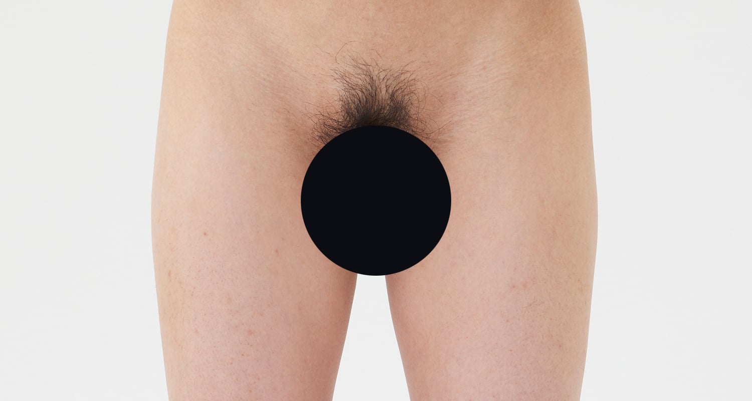 VIO脱毛の症例一覧