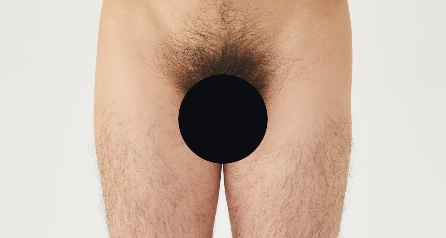 VIO脱毛の症例一覧