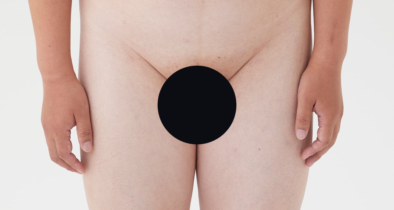 VIO脱毛の症例一覧