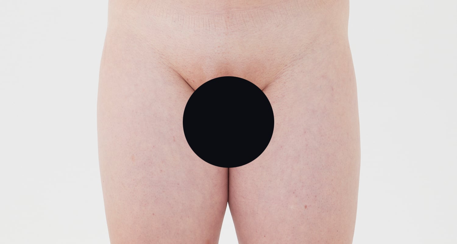 VIO脱毛の症例一覧