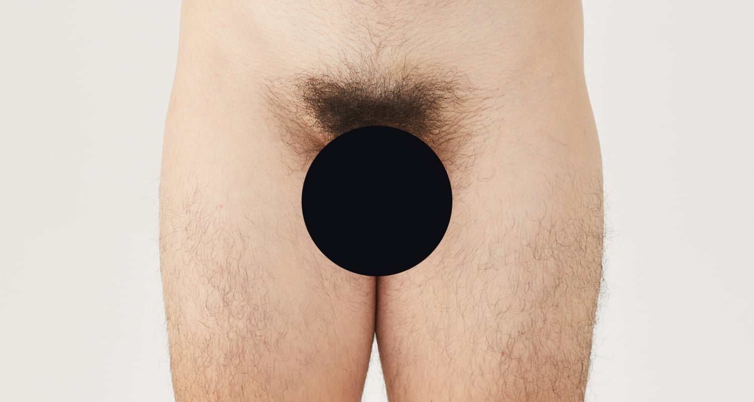 VIO脱毛の症例一覧