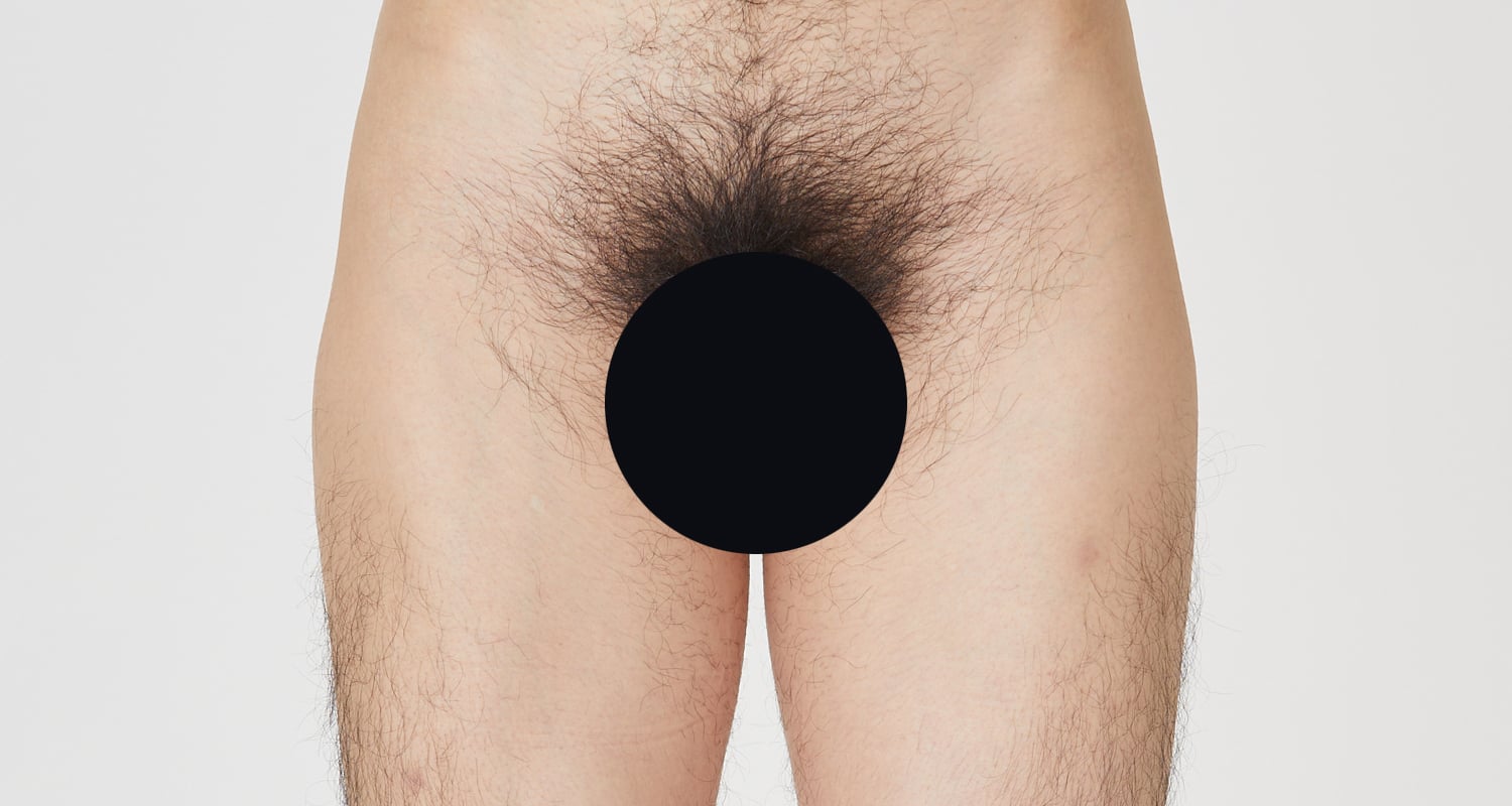 VIO脱毛の症例一覧