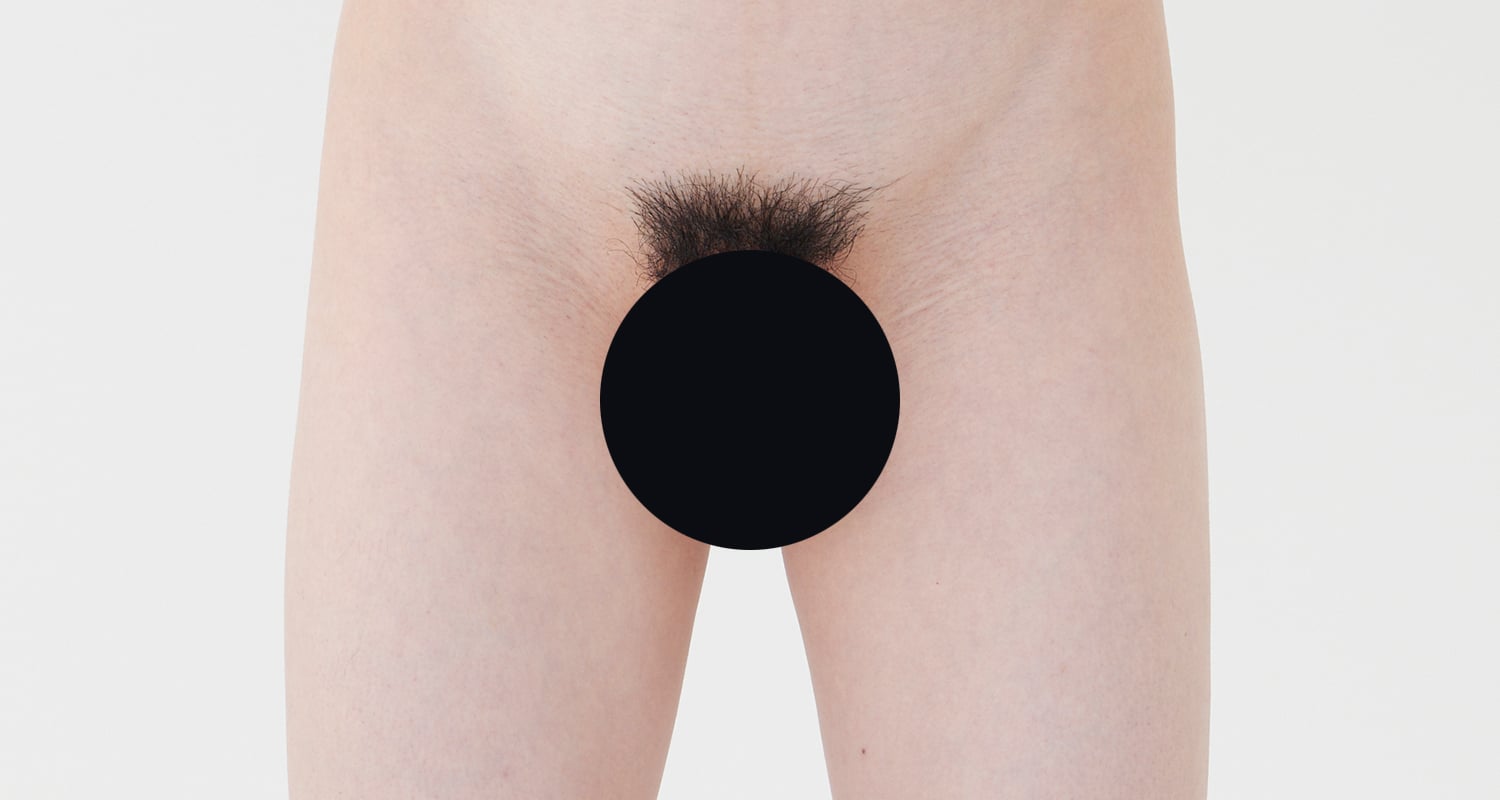 VIO脱毛の症例一覧