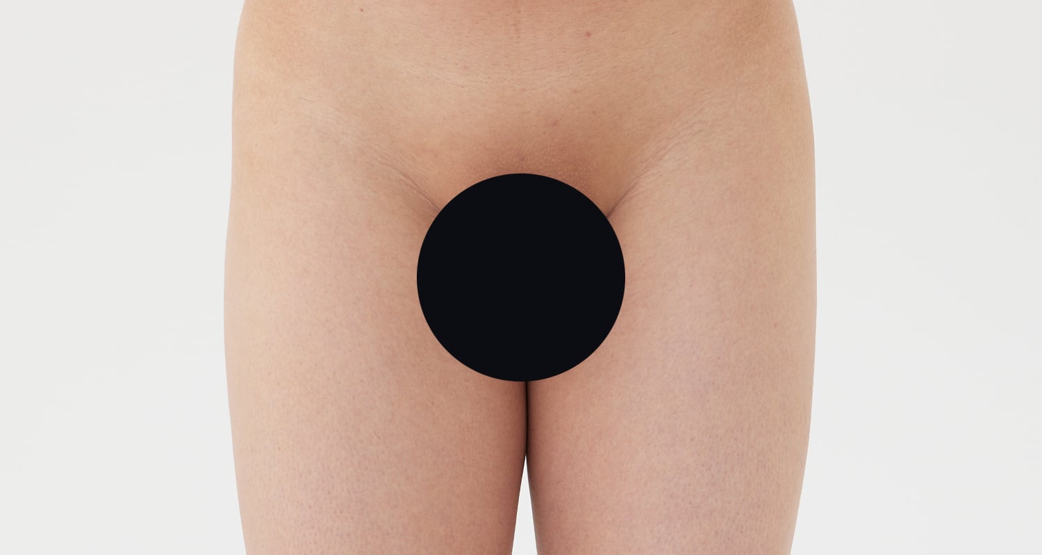 VIO脱毛の症例一覧