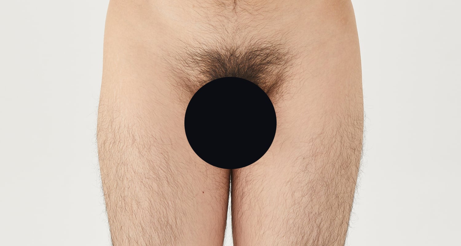 VIO脱毛の症例一覧