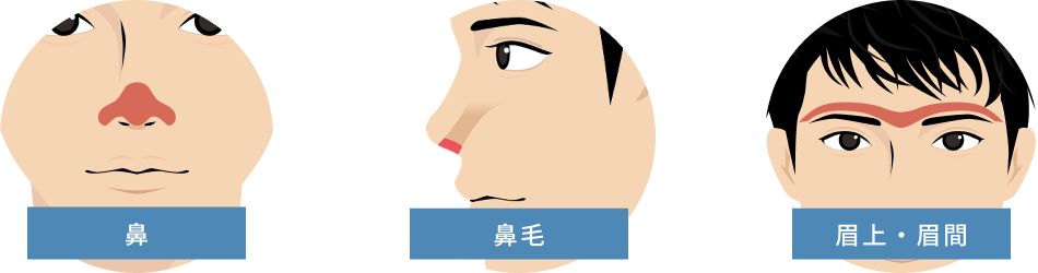 顔全体オプションの照射範囲