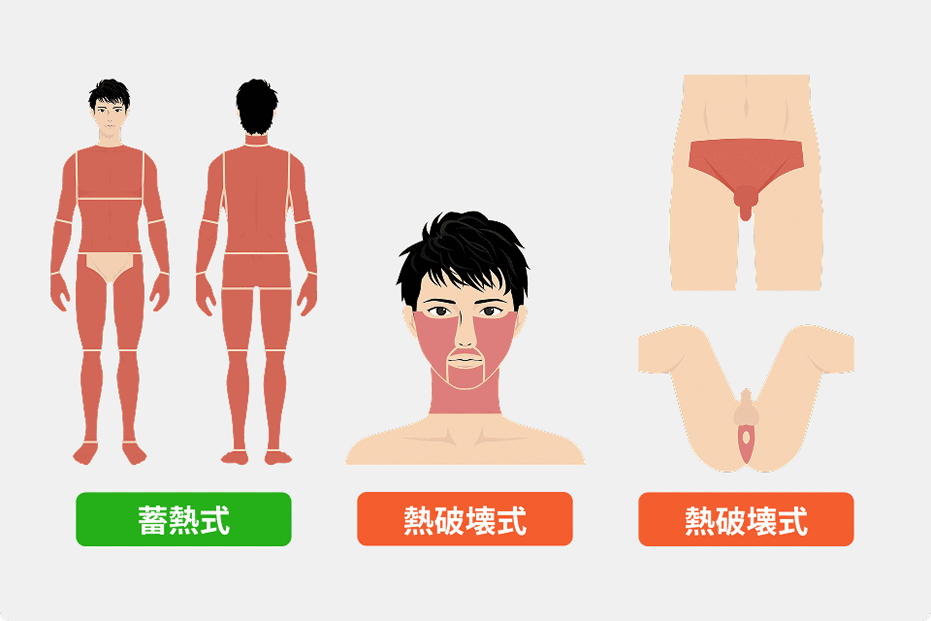 全身 + ヒゲ + VIO脱毛の照射範囲