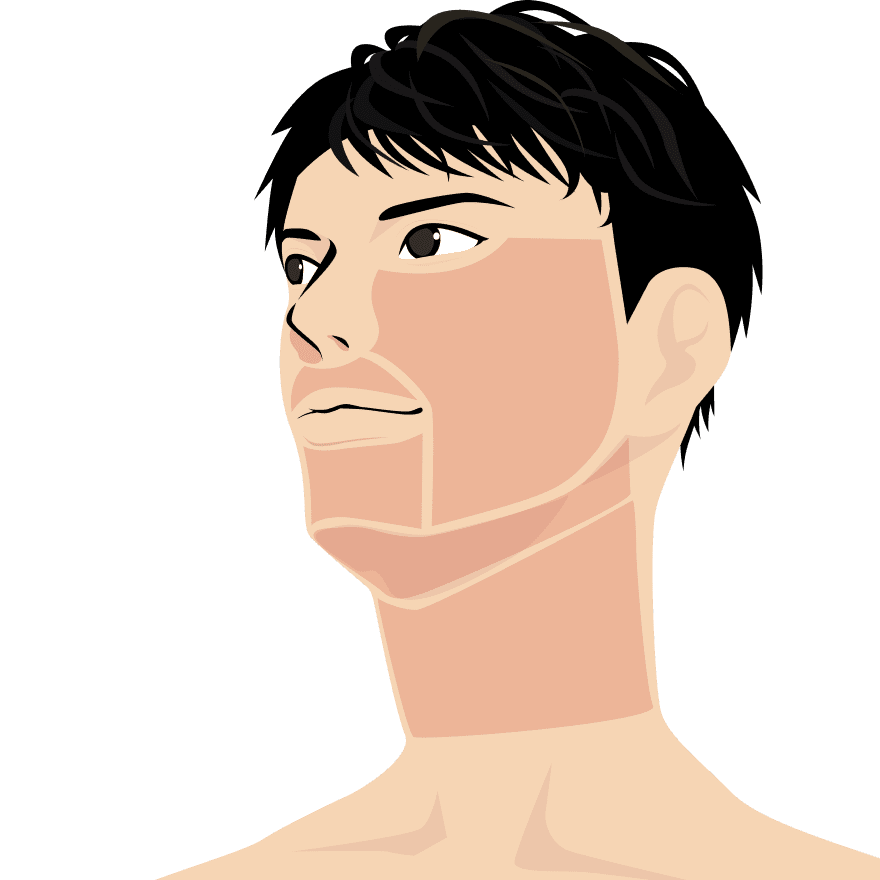 ヒゲ脱毛 部位別の照射範囲