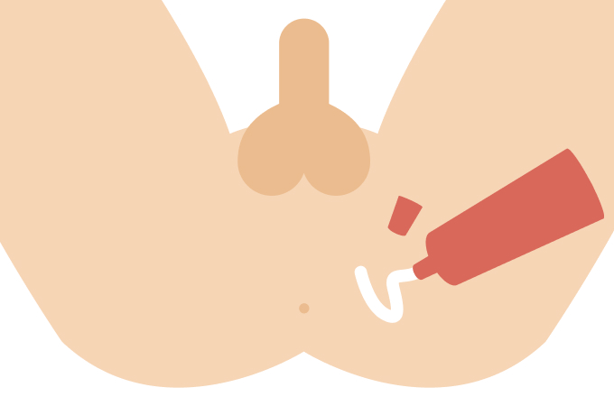 STEP（4）アフターケアを万全にする