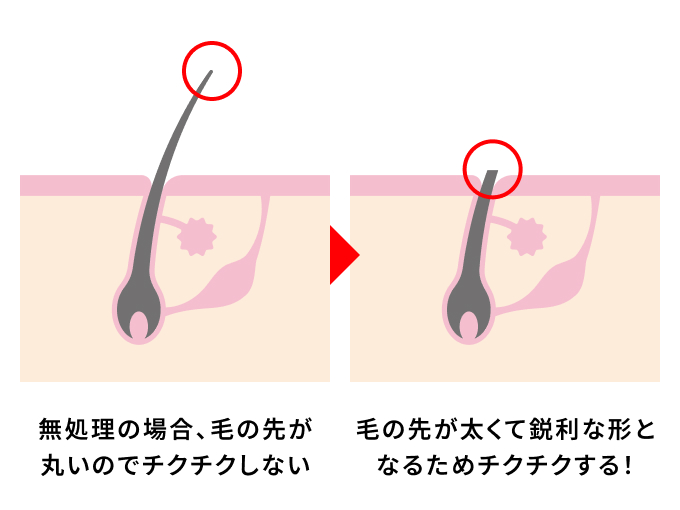 毛を剃るとチクチクする仕組み