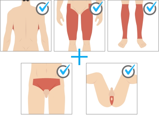 セレクト全身脱毛イメージ画像