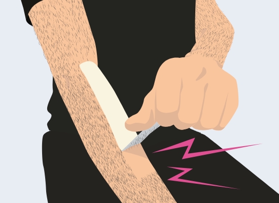 アスリート脱毛