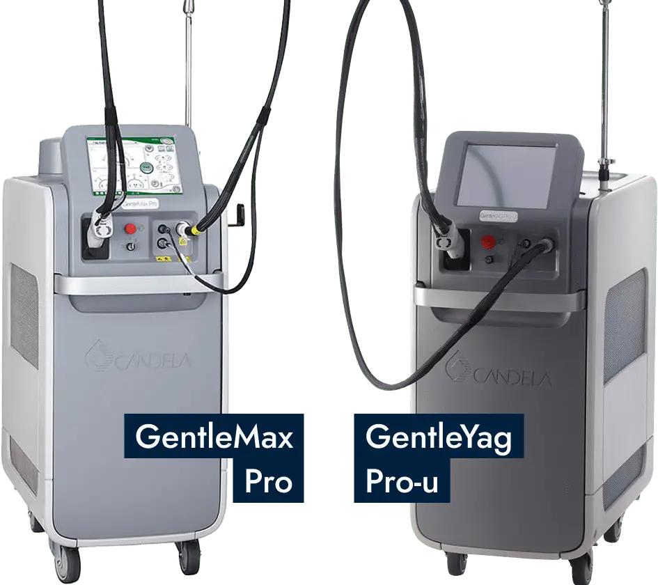 メンズリゼのヒゲ脱毛で使用する「熱破壊式ヤグレーザー」