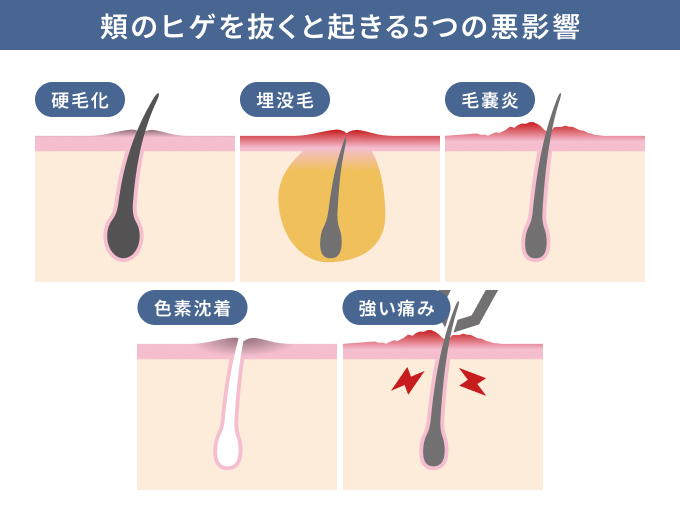 頬のヒゲを抜くと起きる5つの悪影響
