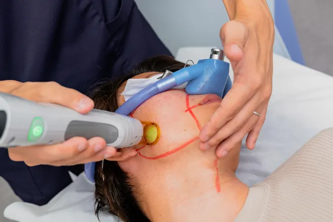 医療脱毛は麻酔が使用可能