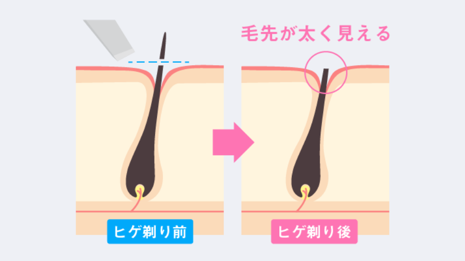 青ヒゲになるメカニズム