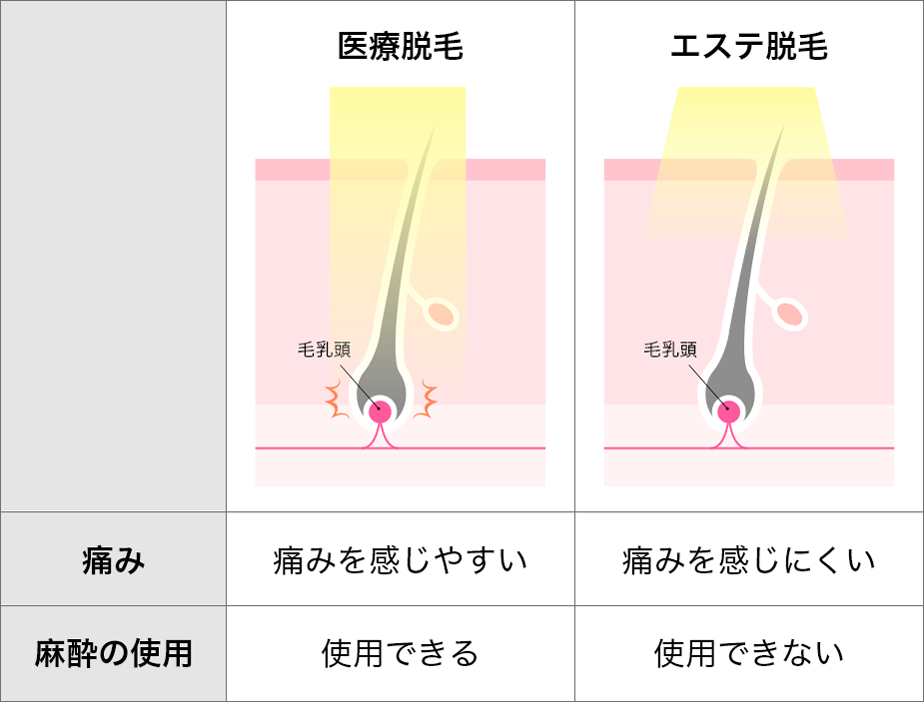 表：痛みの違い