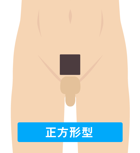 男性の陰部デザイン