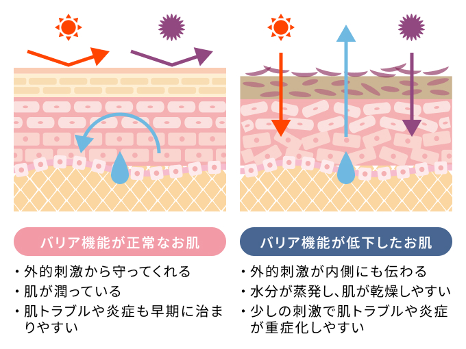 脱毛による刺激で一時的に肌のバリア機能が低下する