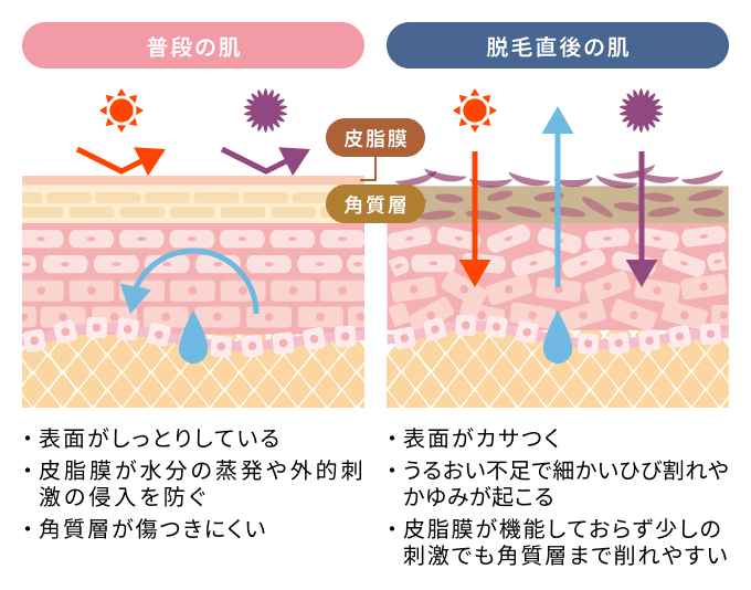 脱毛直後の肌は乾燥しやすい