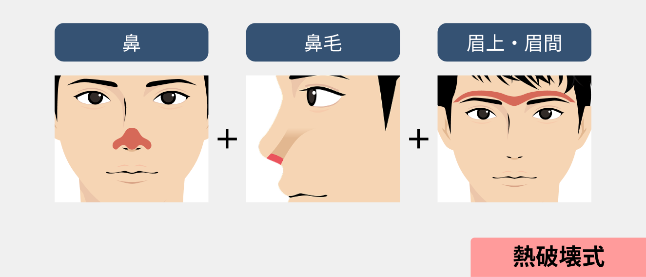 イラスト：顔全体オプション