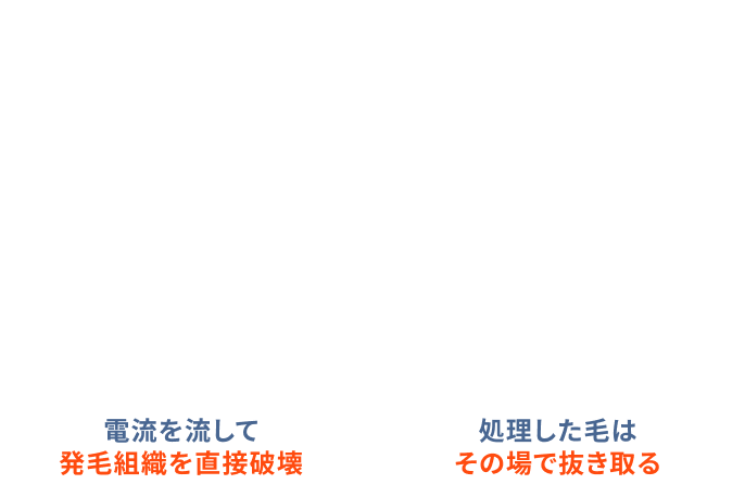 1本ずつ確実に脱毛でき、効果をすぐに実感できる