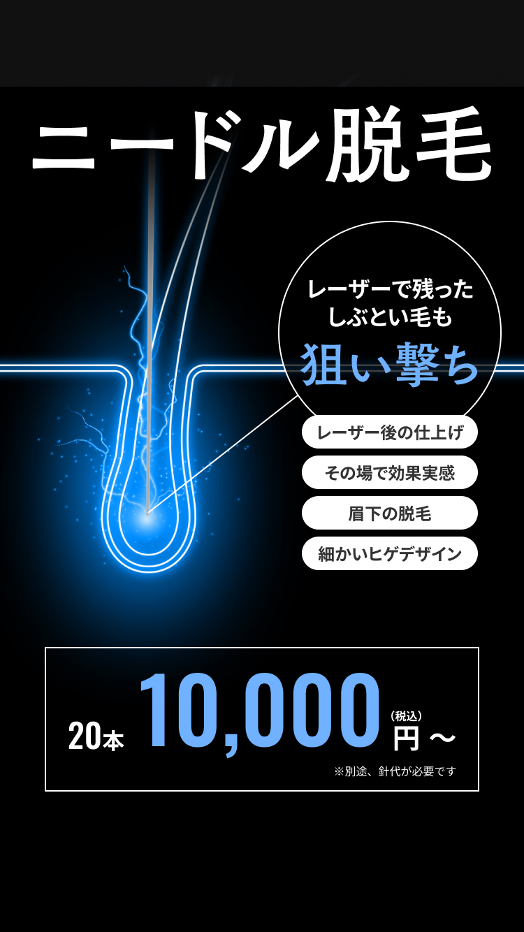 ニードル脱毛（針脱毛）｜【公式】男性脱毛のメンズリゼ