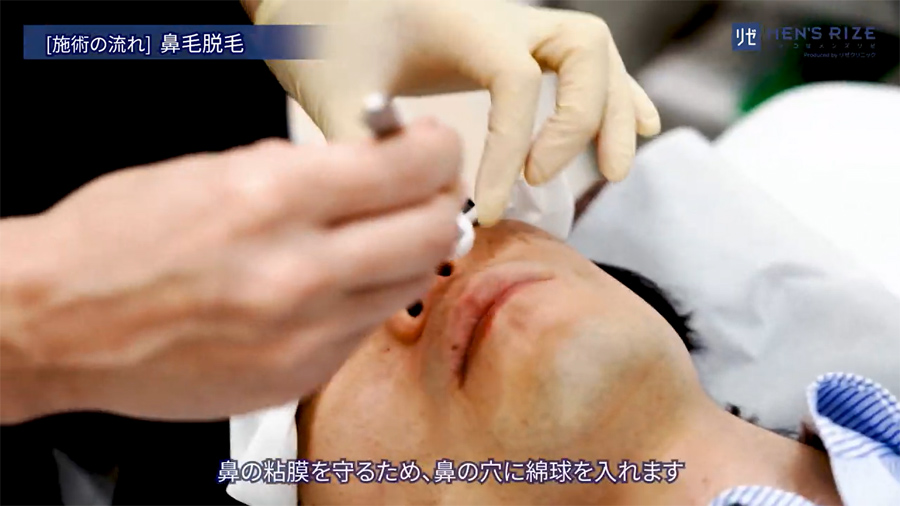 鼻の穴に綿球を入れます。