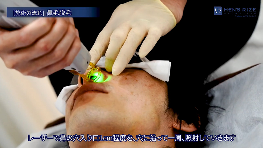レーザーで鼻の入口を照射します。