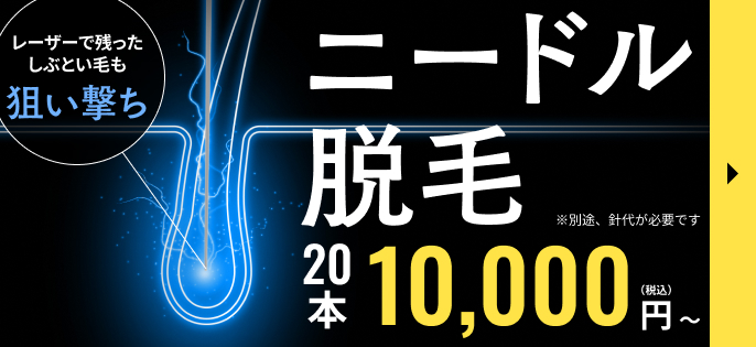 ニードル脱毛 20本10,000円～