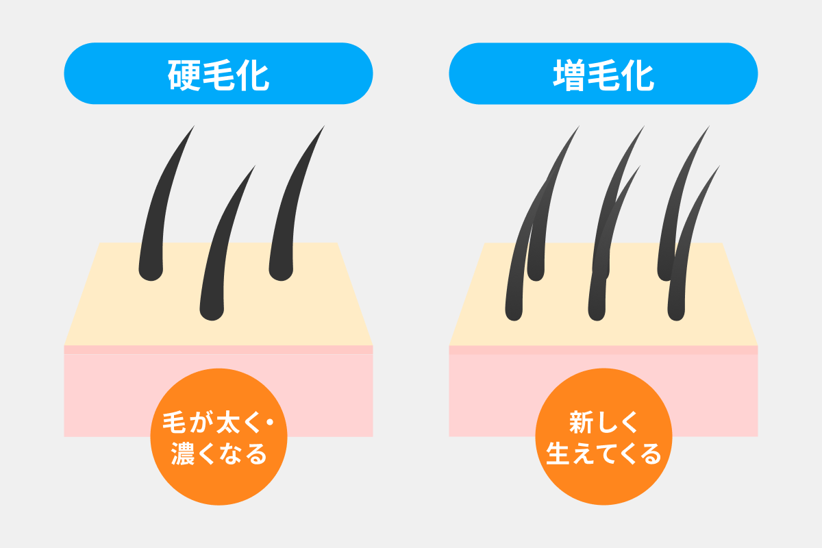 硬毛化・増毛化のイメージ