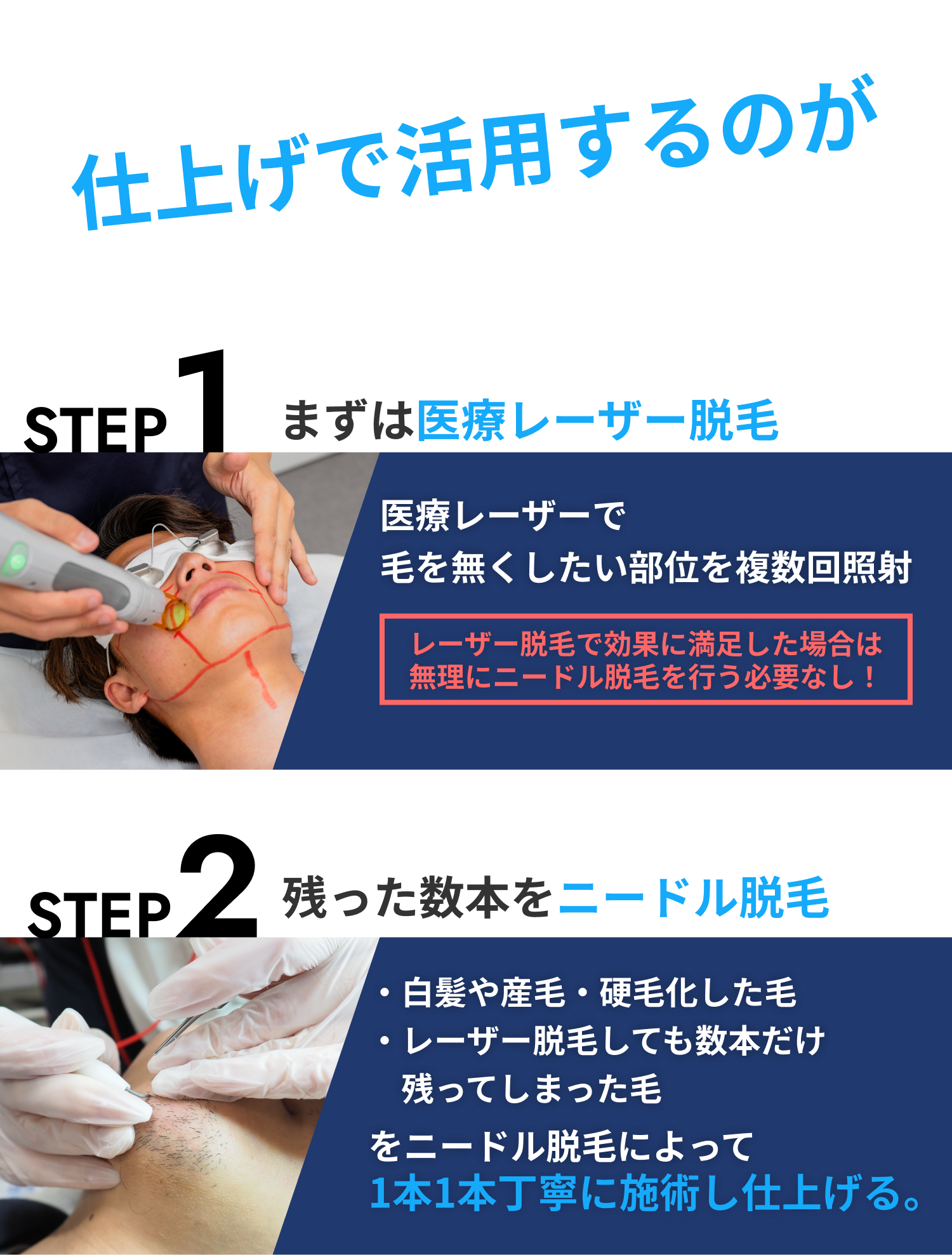 針脱毛は仕上げで活用するのがおすすめ！