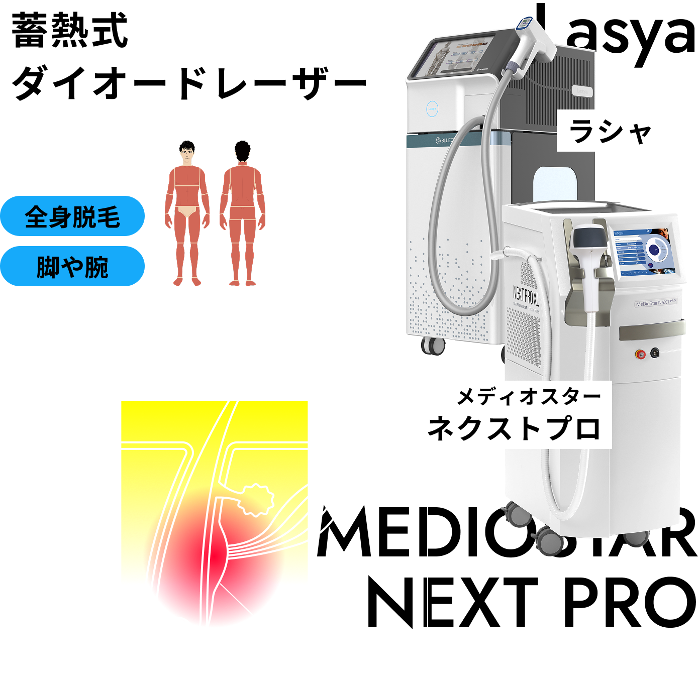 蓄熱式ダイオードレーザー