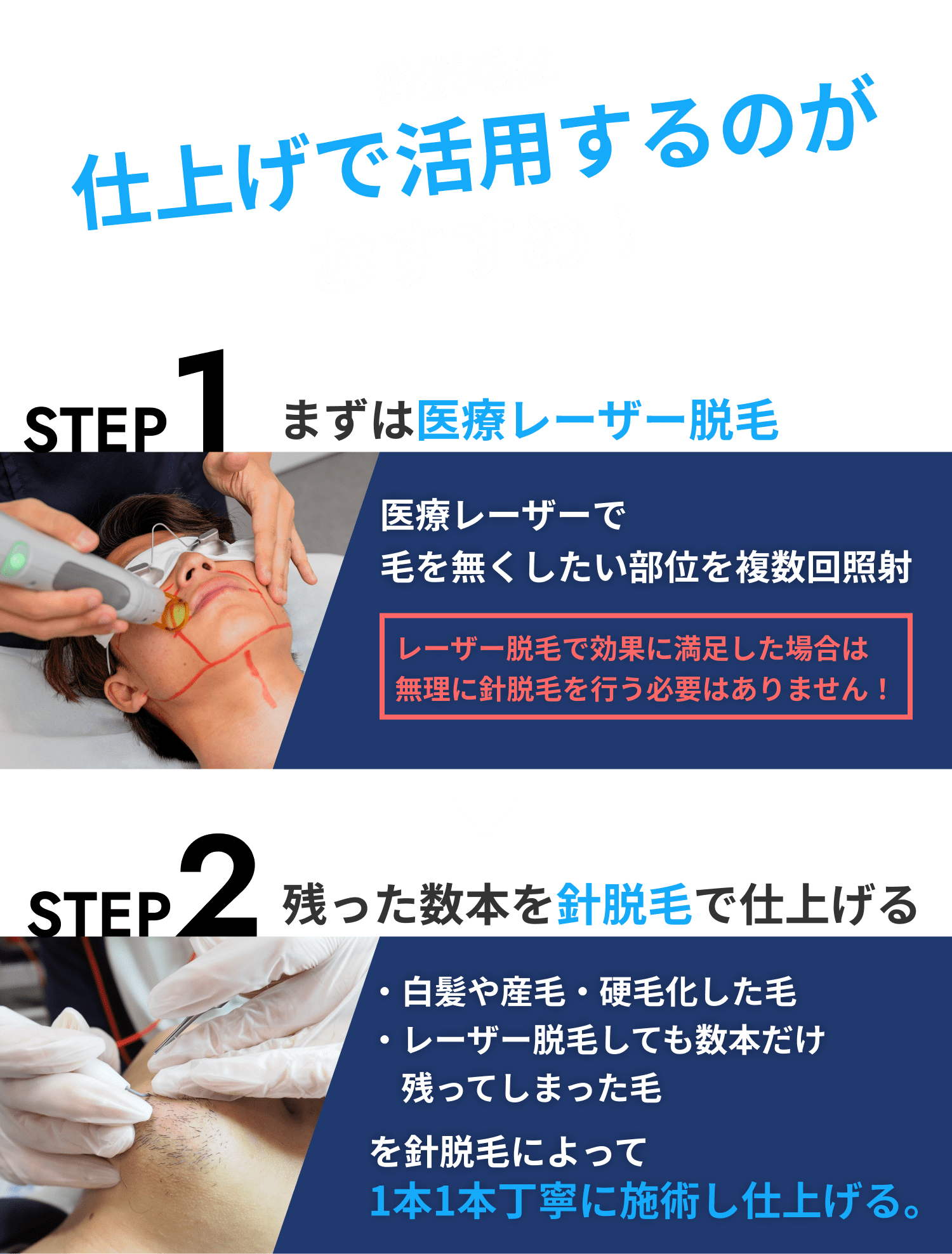 針脱毛は仕上げで活用するのがおすすめ！