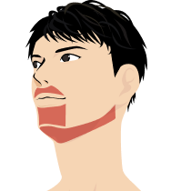 ヒゲ脱毛(3部位)