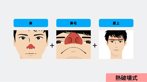 顔全体オプション