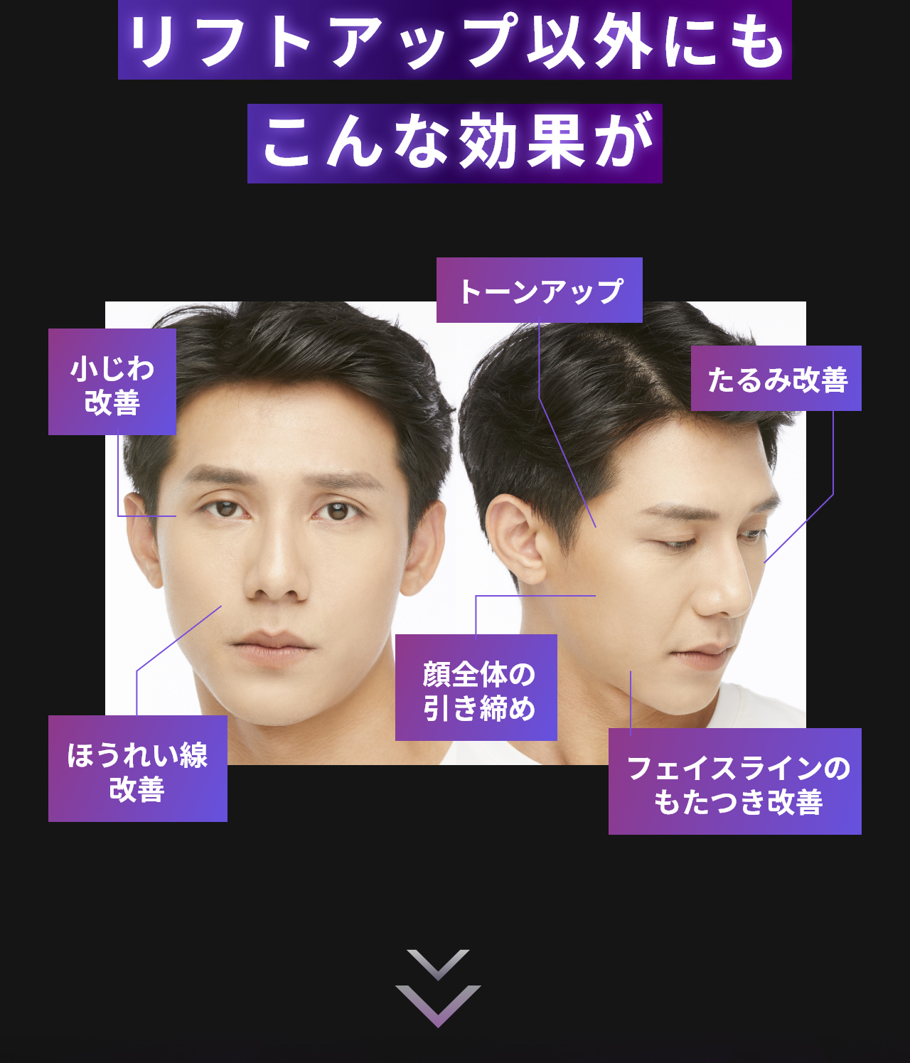 リフトアップ以外にもこんな効果が