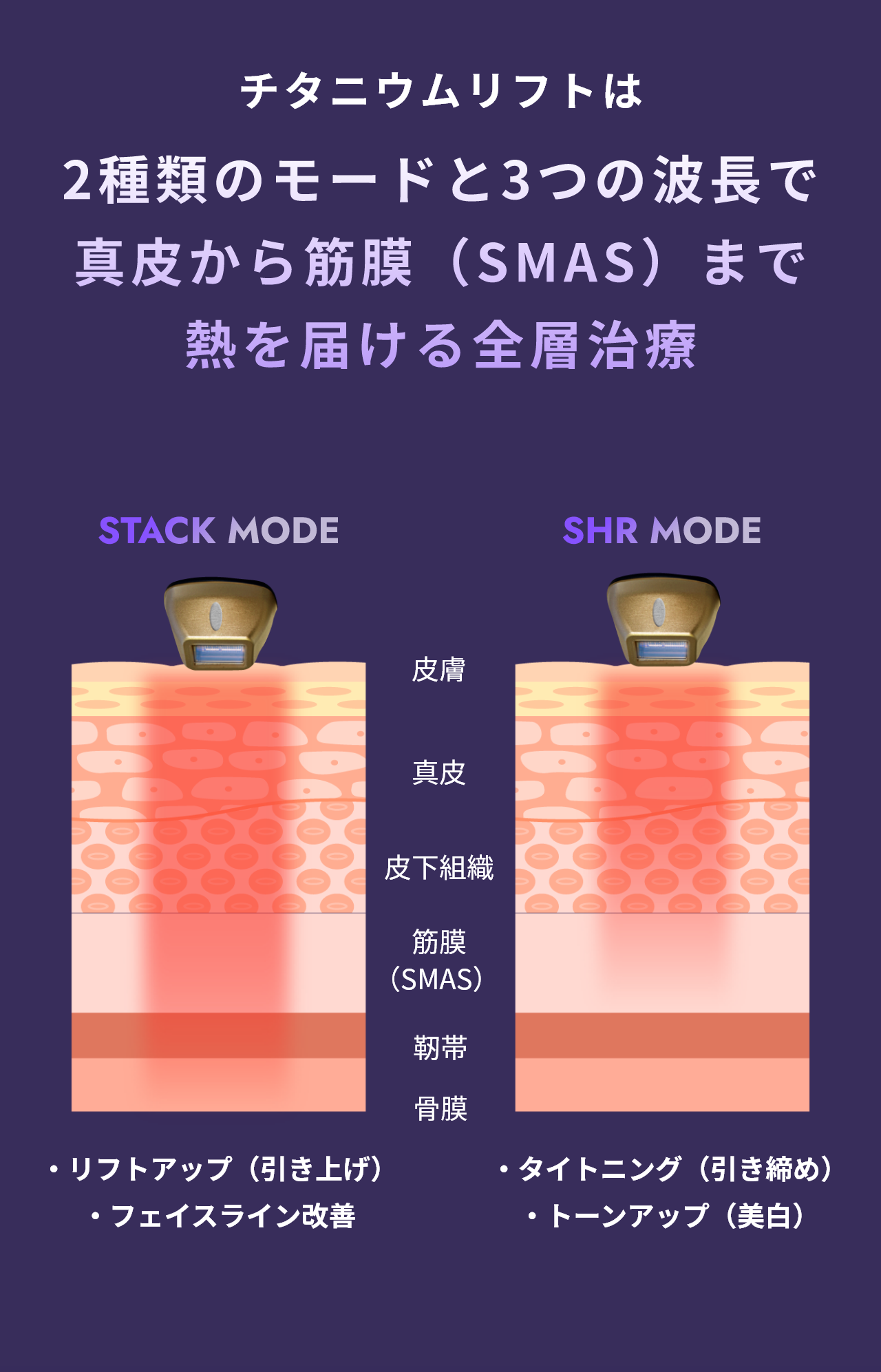 チタニウムリフトは2種類のモードと3つの波長で真皮から筋膜（SMAS）まで熱を届ける全層治療