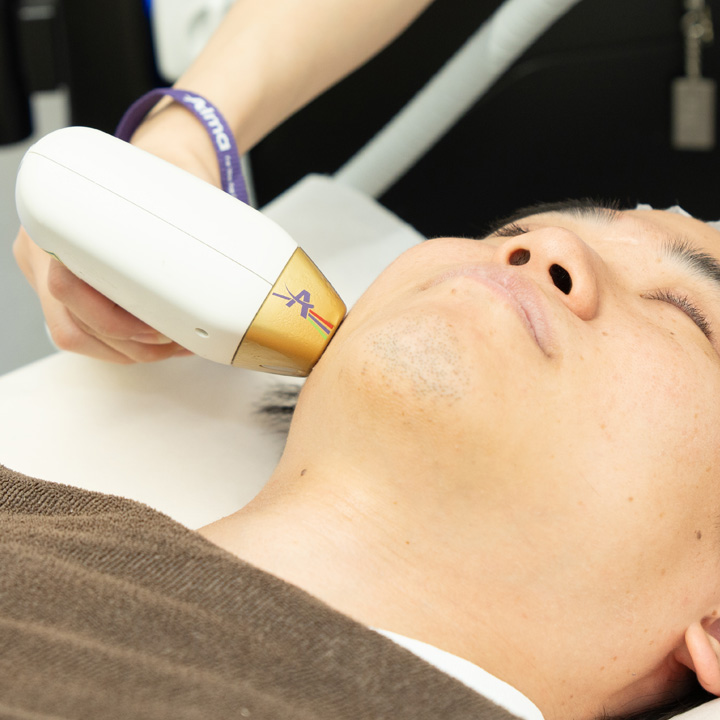 リフトアップレーザー治療