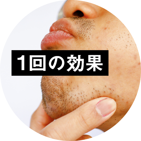 ヒゲ脱毛1回の効果