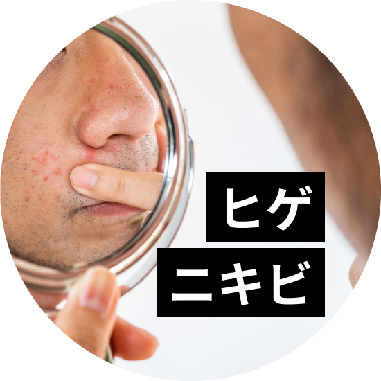 ヒゲにできるニキビの原因と対策方法