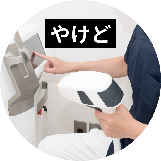 脱毛による火傷（やけど）について