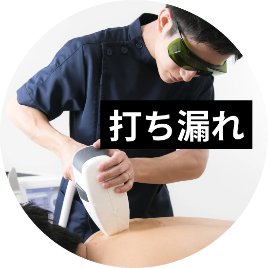 脱毛の打ち漏れについて