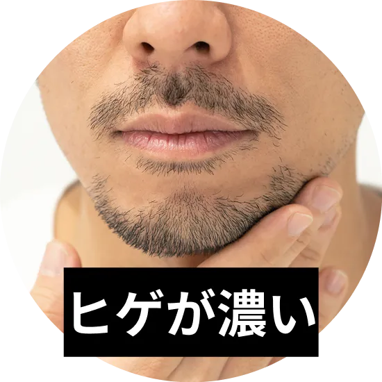 「ヒゲが濃い」と悩む男性へ。濃くなる4つの原因と根本的な改善方法を解説