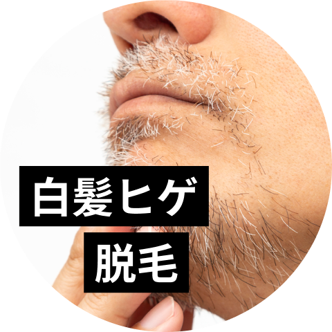 白髪ヒゲも脱毛可能！ニードル脱毛が効果的な理由を解説