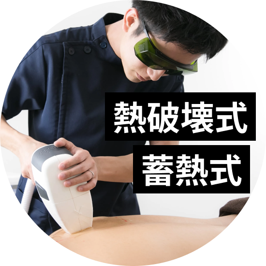熱破壊式と蓄熱式の違いとは？脱毛効果や2種類の使い分けを解説