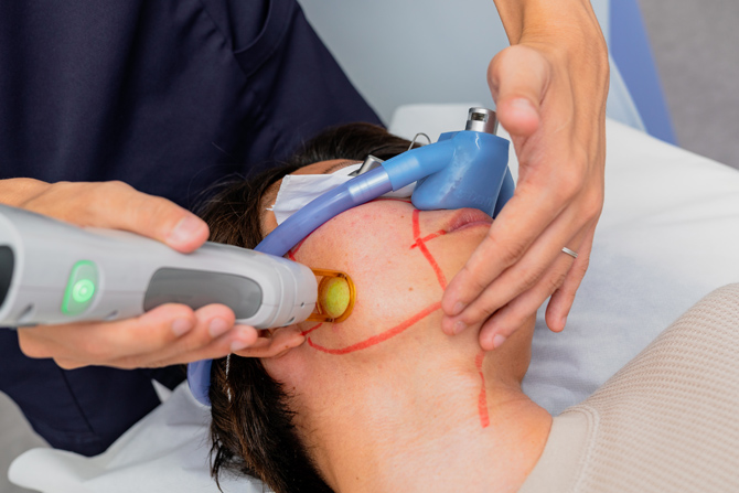 医療脱毛経験者だからこその痛みに寄り添う取り組み